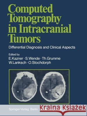 Computed Tomography in Intracranial Tumors: Differential Diagnosis and Clinical Aspects Dougherty, F. C. 9783642966552 Springer