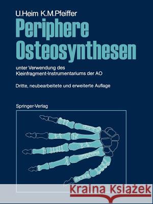 Periphere Osteosynthesen: Unter Verwendung Des Kleinfragment-Instrumentariums Der Ao Oberli, K. 9783642970467 Springer