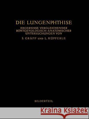 Die Lungenphthise: Ergebnisse Vergleichender Röntgenologisch-Anatomischer Untersuchungen Gräff, Siegfried 9783642986338 Springer