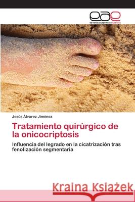 Tratamiento quirúrgico de la onicocriptosis Álvarez Jiménez, Jesús 9783659007538 Editorial Acad Mica Espa Ola