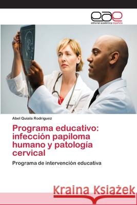 Programa educativo: infección papiloma humano y patología cervical Quiala Rodríguez, Abel 9783659007767