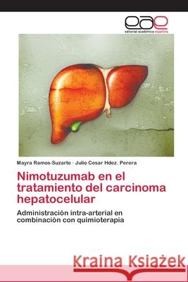 Nimotuzumab en el tratamiento del carcinoma hepatocelular Ramos-Suzarte, Mayra 9783659024368