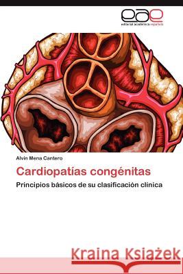 Cardiopatias Congenitas Alvin Men 9783659041266 Editorial Acad Mica Espa Ola