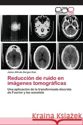 Reducción de ruido en imágenes tomográficas Burgos Díaz, Jaime Alfredo 9783659045707