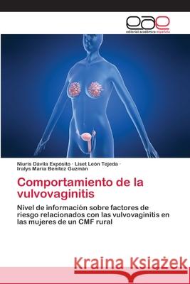 Comportamiento de la vulvovaginitis Niuris Dávila Expósito, Liset León Tejeda, Iralys María Benítez Guzmán 9783659051739 Editorial Academica Espanola