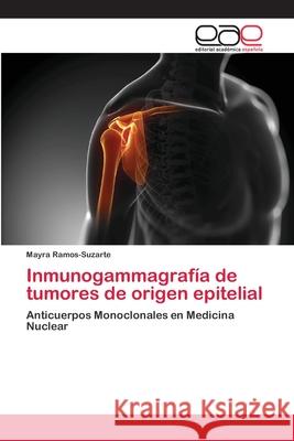 Inmunogammagrafía de tumores de origen epitelial Ramos-Suzarte, Mayra 9783659061844