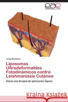 Liposomas Ultradeformables Fotodinámicos contra Leishmaniasis Cutánea Montanari, Jorge 9783659077876 Editorial Academica Espanola