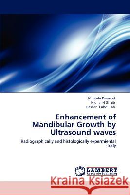 Enhancement of Mandibular Growth by Ultrasound waves Dawood, Mustafa 9783659140778 LAP Lambert Academic Publishing