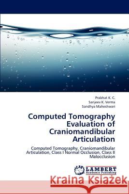 Computed Tomography Evaluation of Craniomandibular Articulation Prabhat K Sanjeev K. Verma Sandhya Maheshwari 9783659141980