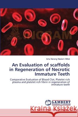 An Evaluation of scaffolds in Regeneration of Necrotic Immature Teeth Neelam Mittal, Isha Narang 9783659147869