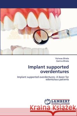 Implant supported overdentures Bhatia, Vishwas 9783659150463 LAP Lambert Academic Publishing