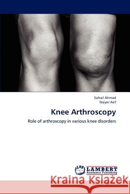 Knee Arthroscopy Sohail Ahmad, Naiyer Asif 9783659152610