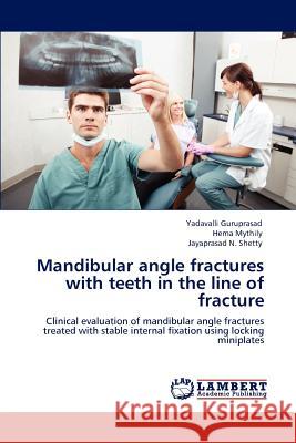 Mandibular angle fractures with teeth in the line of fracture Yadavalli Guruprasad, Hema Mythily, Jayaprasad N Shetty 9783659164934 LAP Lambert Academic Publishing