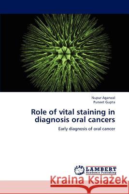 Role of vital staining in diagnosis oral cancers Agarwal, Nupur 9783659174957 LAP Lambert Academic Publishing