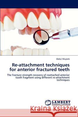 Re-attachment techniques for anterior fractured teeth Mujeeb, Abdul 9783659190773 LAP Lambert Academic Publishing