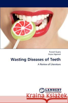 Wasting Diseases of Teeth Puneet Gupta Nupur Agarwal 9783659191220 LAP Lambert Academic Publishing