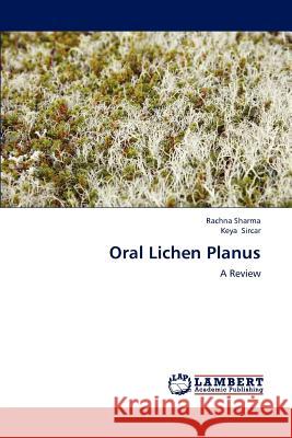 Oral Lichen Planus Rachna Sharma Keya Sircar 9783659192944 LAP Lambert Academic Publishing