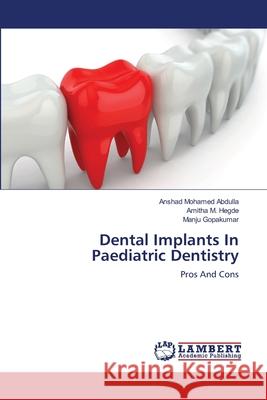 Dental Implants In Paediatric Dentistry Abdulla, Anshad Mohamed 9783659232503