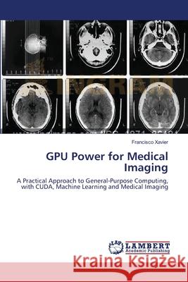 GPU Power for Medical Imaging Xavier, Francisco 9783659251894 LAP Lambert Academic Publishing