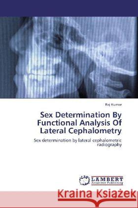 Sex Determination By Functional Analysis Of Lateral Cephalometry : Sex determination by lateral cephalometric radiography Kumar, Raj 9783659252532 LAP Lambert Academic Publishing