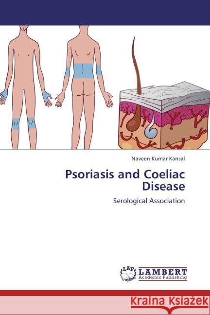 Psoriasis and Coeliac Disease : Serological Association Kansal, Naveen Kumar 9783659255335 LAP Lambert Academic Publishing