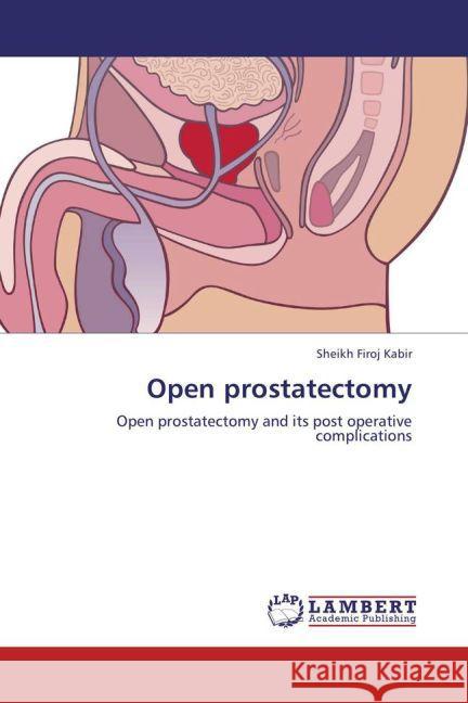 Open prostatectomy : Open prostatectomy and its post operative complications Kabir, Sheikh Firoj 9783659276590 LAP Lambert Academic Publishing