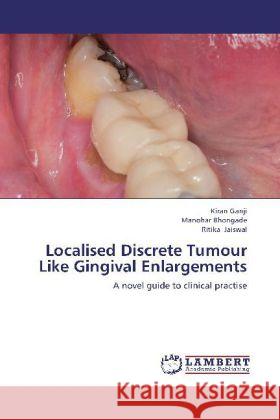 Localised Discrete Tumour Like Gingival Enlargements : A novel guide to clinical practise Ganji, Kiran; Bhongade, Manohar; Jaiswal, Ritika 9783659277320