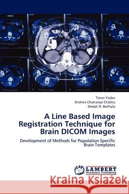 A Line Based Image Registration Technique for Brain Dicom Images Yadav Tarun, Chakka Krishna Chaitanya, Bathula Deepti R 9783659277733 LAP Lambert Academic Publishing