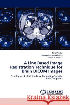 A Line Based Image Registration Technique for Brain Dicom Images Yadav Tarun, Chakka Krishna Chaitanya, Bathula Deepti R 9783659277733