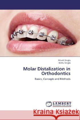 Molar Distalization in Orthodontics : Basics, Concepts and Methods Singla, Ritesh; Singla, Nishu 9783659278136 LAP Lambert Academic Publishing