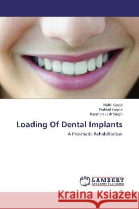 Loading Of Dental Implants : A Prosthetic Rehabilitation Goyal, Nidhi; Gupta, Prahlad; Singh, Karanprakash 9783659279416 LAP Lambert Academic Publishing