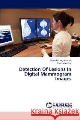 Detection of Lesions in Digital Mammogram Images Langarizadeh Mostafa, Mahmud Rozi 9783659309328 LAP Lambert Academic Publishing