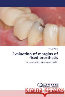 Evaluation of Margins of Fixed Prosthesis Abidi Yawar 9783659370526 LAP Lambert Academic Publishing