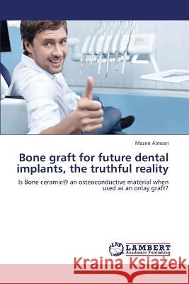 Bone Graft for Future Dental Implants, the Truthful Reality Almasri Mazen 9783659396823