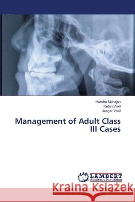 Management of Adult Class III Cases Mahajan Harsha                           Vakil Ketan                              Vakil Jeegar 9783659397219