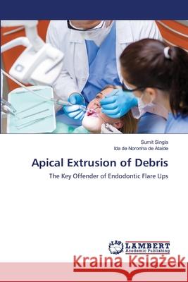 Apical Extrusion of Debris Sumit Singla, Ida de Noronha de Ataide 9783659415036 LAP Lambert Academic Publishing