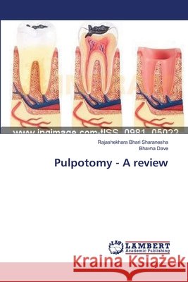 Pulpotomy - A review Bhari Sharanesha, Rajashekhara 9783659426131