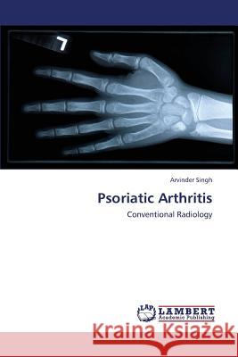 Psoriatic Arthritis Singh Arvinder 9783659431364 LAP Lambert Academic Publishing