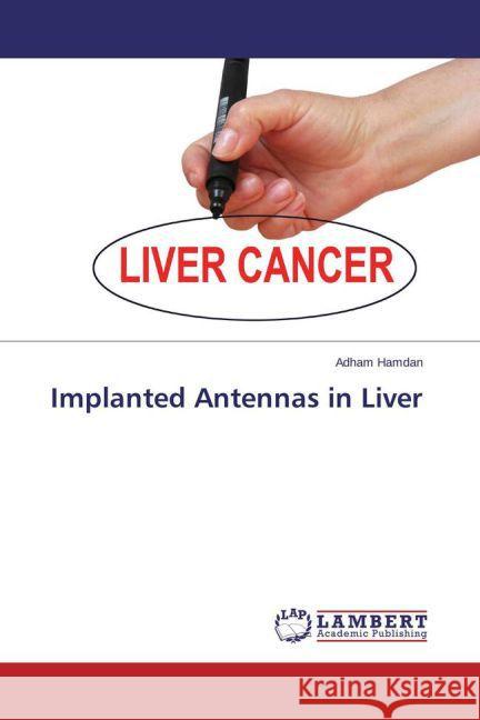 Implanted Antennas in Liver Hamdan, Adham 9783659436710