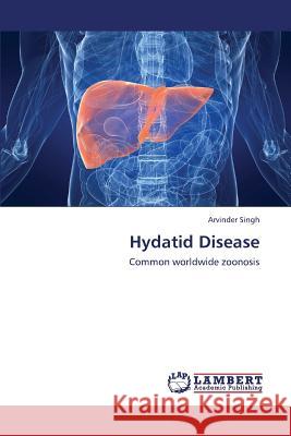 Hydatid Disease Singh Arvinder 9783659437205 LAP Lambert Academic Publishing