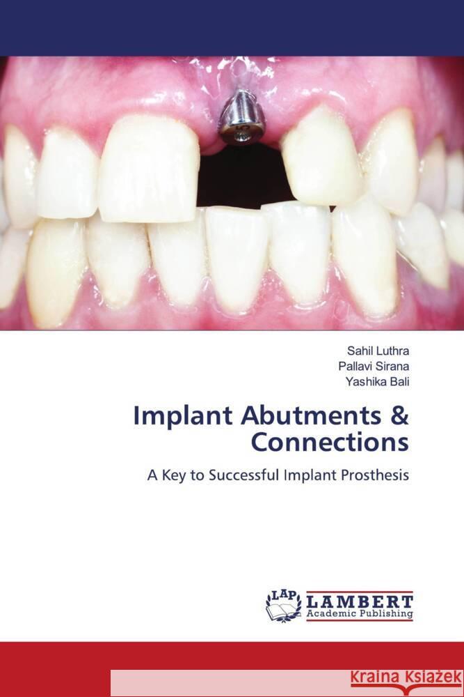 Implant Abutments & Connections Luthra, Sahil, Sirana, Pallavi, Bali, Yashika 9783659466410