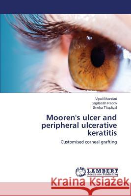 Mooren's ulcer and peripheral ulcerative keratitis Bhandari Vipul 9783659502675