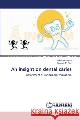 An insight on dental caries Gupta, Ashutosh 9783659518065