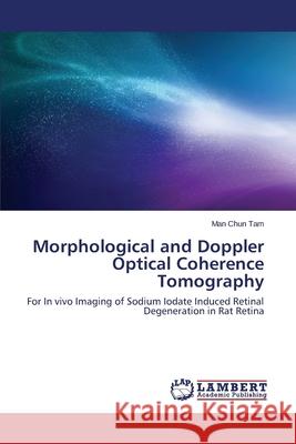 Morphological and Doppler Optical Coherence Tomography Tam Man Chun 9783659527050 LAP Lambert Academic Publishing