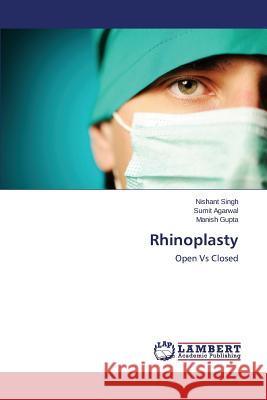 Rhinoplasty Singh Nishant 9783659539602 LAP Lambert Academic Publishing