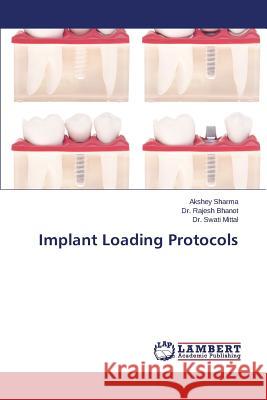 Implant Loading Protocols Sharma Akshey                            Bhanot Rajesh                            Mittal Swati 9783659539794