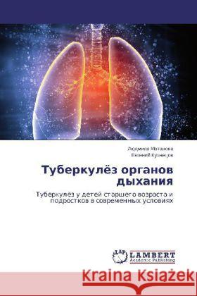 Tuberkulyez organov dykhaniya : Tuberkulyez u detey starshego vozrasta i podrostkov v sovremennykh usloviyakh Motanova, Lyudmila; Kuznetsov, Evgeniy 9783659543876