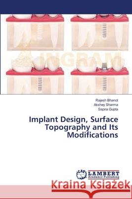 Implant Design, Surface Topography and Its Modifications Bhanot Rajesh                            Sharma Akshey                            Gupta Sapna 9783659549250