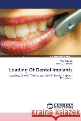 Loading Of Dental Implants Debnath, Nitai 9783659557620