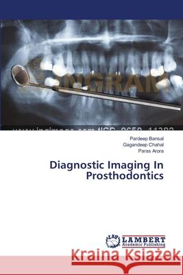 Diagnostic Imaging In Prosthodontics Bansal Pardeep                           Chahal Gagandeep                         Arora Paras 9783659560439